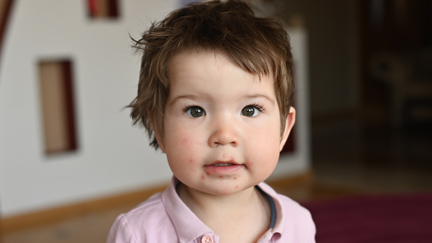 European Paediatric Formulary: Flecainide acetate oral solution and Valaciclovir oral solution monographs in public consultation
