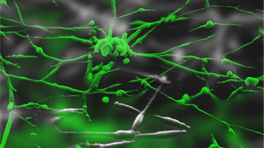 EPC adopts mycoplasmas general chapter and monographs, updated to incorporate latest analytical developments